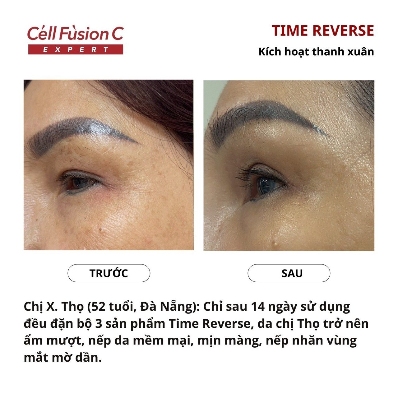 Tinh chất săn chắc da,  hỗ trợ ngăn ngừa lão hóa 3in1 130ml - Cell Fusion C Expert Time Reverse Concentrate Essense