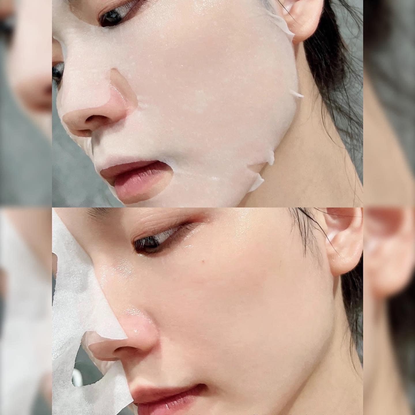 Mặt Nạ Dịu Da Khẩn Cấp 27g x 5 miếng - Cell Fusion C Post α First Cooling Mask 