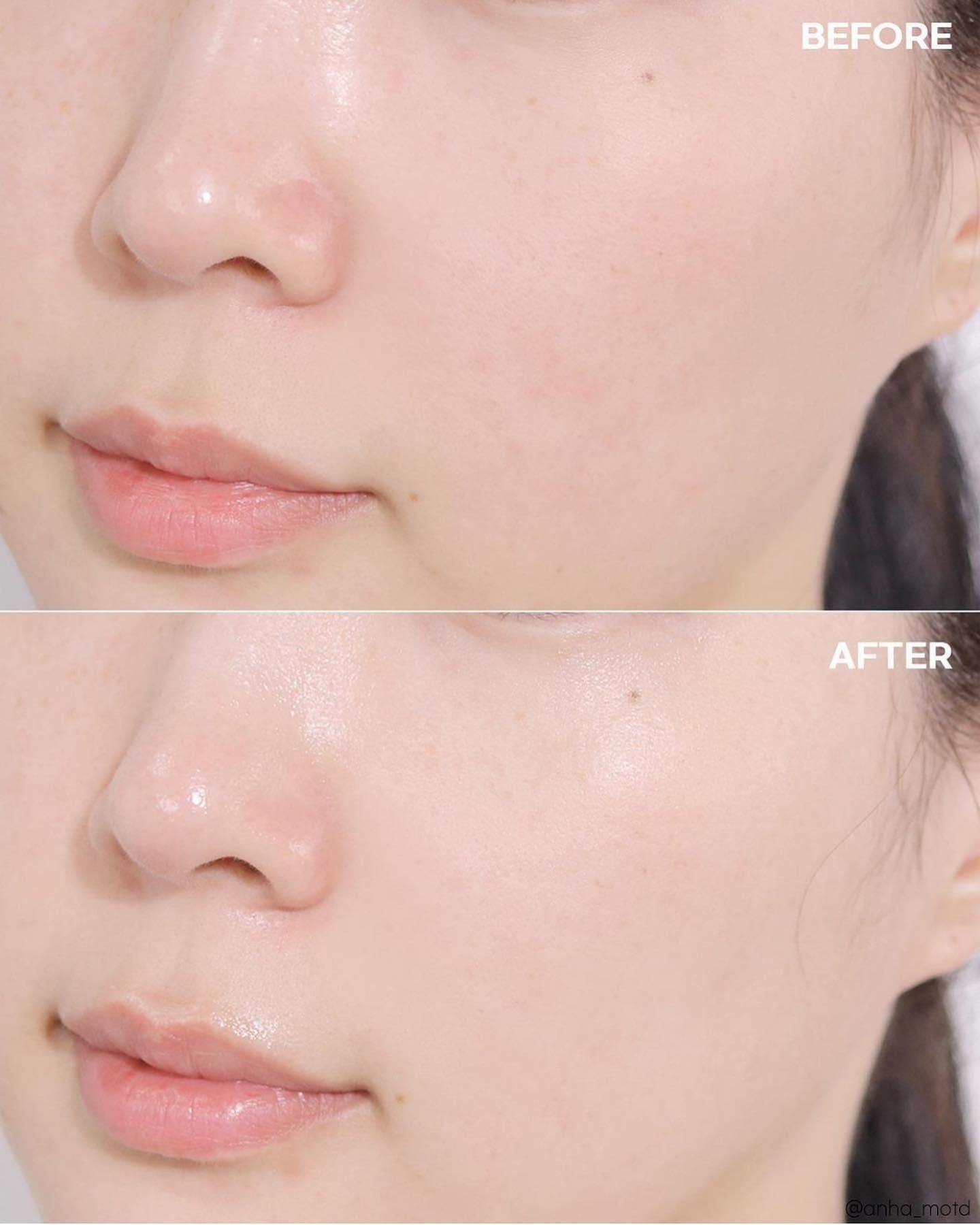 Mặt Nạ Dịu Da Khẩn Cấp 27g x 5 miếng - Cell Fusion C Post α First Cooling Mask 