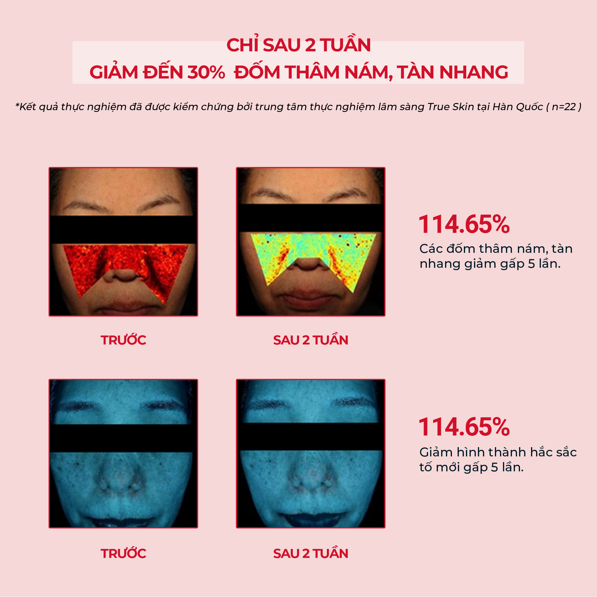 Serum ANGEL'S LIQUID TRANEXAMIC MELA ZERO AMPOULE hỗ trợ giảm thâm nám chuyên biệt (chai 30ml)