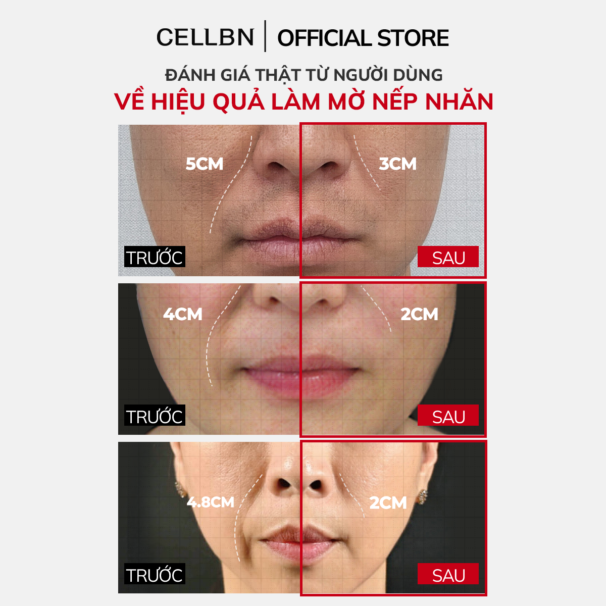 Combo giảm nếp nhăn chuyên sâu và hỗ trợ cải thiện dấu hiệu lão hóa