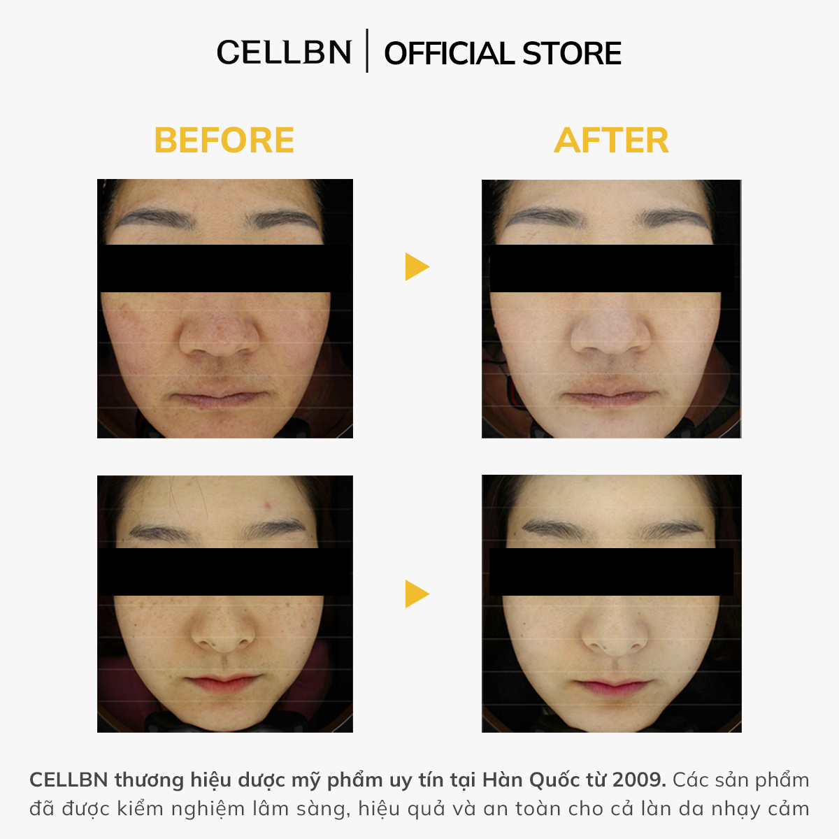 Serum Trắng Da Mờ Thâm Nám Glutathione 20.000ppm CELLBN hỗ trợ sáng da 30ml