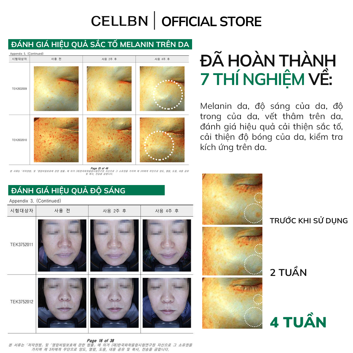 Set Hỗ Trợ Giảm Sắc Tố - Giảm Sạm Nám An Toàn - Kem Blemish Spot Cream & Gel Black Spot Patch - 5